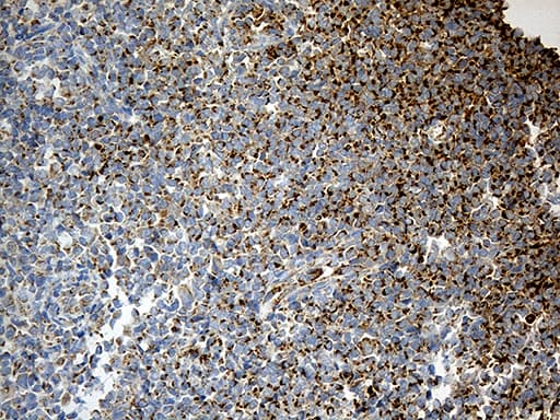 MCAD / ACADM Antibody (clone OTI2G7)