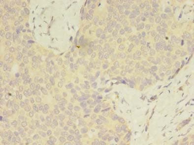 Polyclonal Rabbit anti-Human C2orf69 Antibody (IHC)