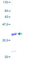 Human GNGT2 Protein (Recombinant GST)