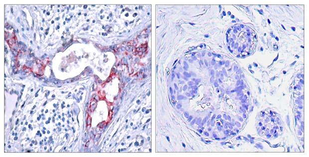 GSK3B / GSK3 Beta Antibody (phospho-Ser9)