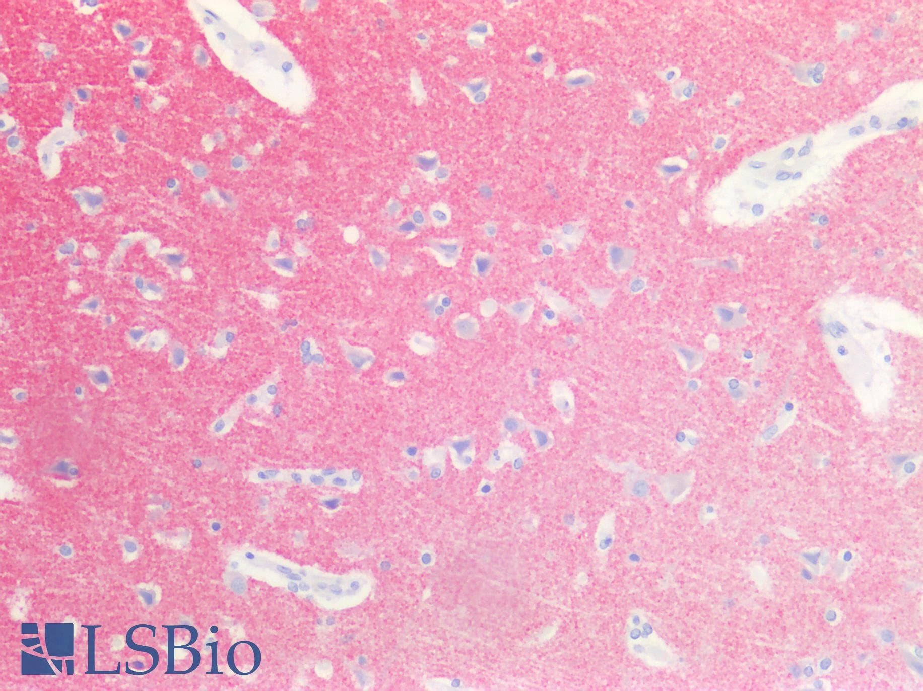IHC-plus™ Polyclonal Rabbit anti-Human SYP / Synaptophysin Antibody (IHC, WB)