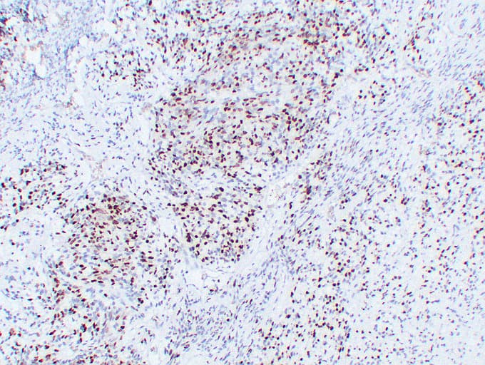 MYOG / Myogenin Antibody (clone ABT-MYOG)