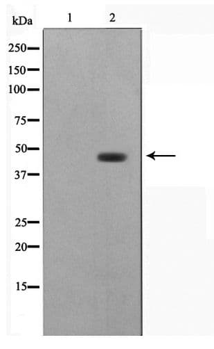 STRADA / LYK5 Antibody