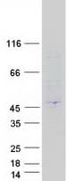 Human PEX16 Protein (Recombinant Myc-DDK (Flag))