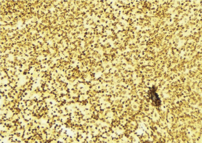 Polyclonal Rabbit anti-Human Hairless / HR Antibody (IHC, IF, WB)