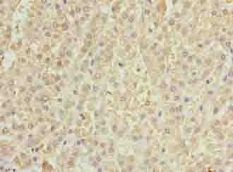 PRDM14 Antibody