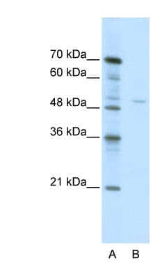 Polyclonal Rabbit anti-Human TRIM38 Antibody (C-Terminus, IHC, WB)
