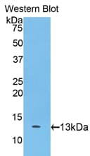 CDH2 / N Cadherin Antibody (aa685-784)