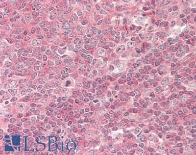 IHC-plus™ STK24 / MST3 Antibody