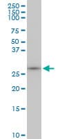 MAGE12 / MAGEA12 Antibody (clone 3A10)