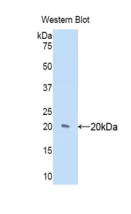 Polyclonal Rabbit anti-Human MMP9 / Gelatinase B Antibody (Biotin, aa213-399, WB)