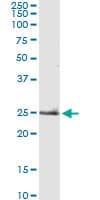 IHC-plus™ TNF Alpha Antibody (clone M 1 C4)