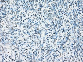 CRYAB / Alpha B Crystallin Antibody (clone OTI6G5)