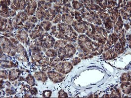 IHC-plus™ ACAA2 Antibody (clone 1C10)