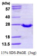 Human GPX2 Protein (Recombinant His)