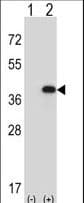 IHC-plus™ Polyclonal Rabbit anti-Human FBP1 Antibody (aa1-31, IHC, WB)