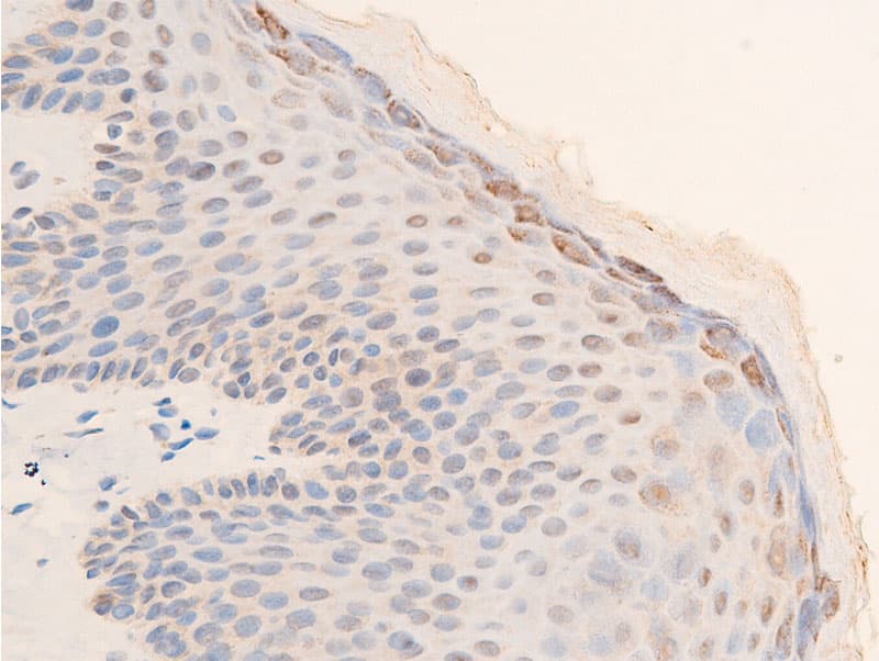 CHEK2 / CHK2 Antibody (phospho-Thr68)