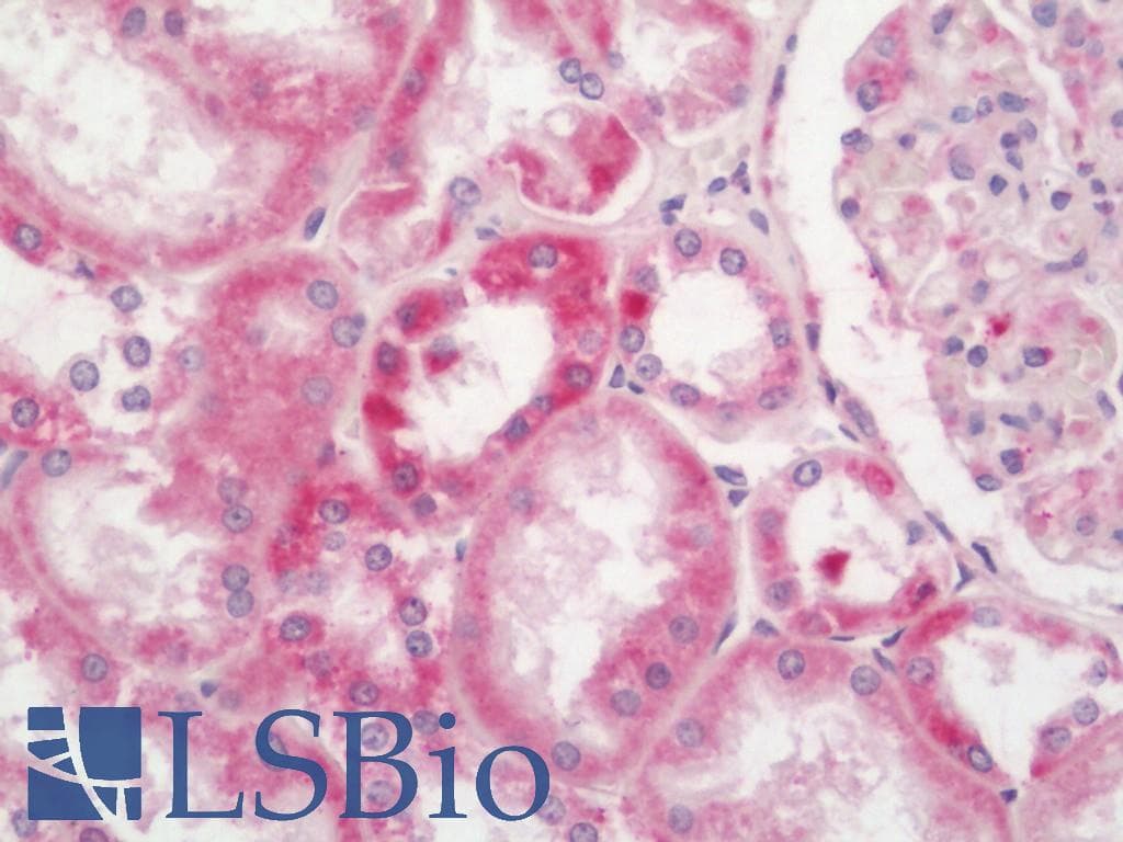 IHC-plus™ IDH3B Antibody