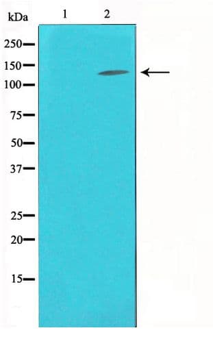 NOS3 / eNOS Antibody
