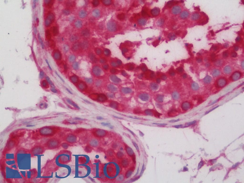 IHC-plus™ Polyclonal Rabbit anti-Human PPM1F Antibody (aa275-303, IHC, WB)