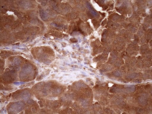 Monoclonal Mouse anti-Human FSCN1 / Fascin Antibody (clone OTI3B4, IHC, WB)