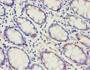 Polyclonal Rabbit anti-Human ACAD9 Antibody (aa1-270, IHC, WB)