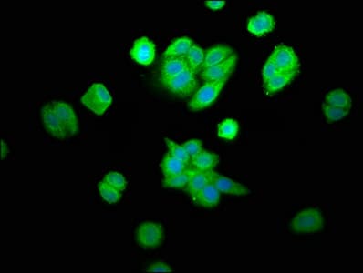 Polyclonal Rabbit anti-Human CPOX Antibody (IF, WB)