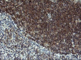 Monoclonal Mouse anti-Human LZIC Antibody (clone OTI1D5, IHC, WB)