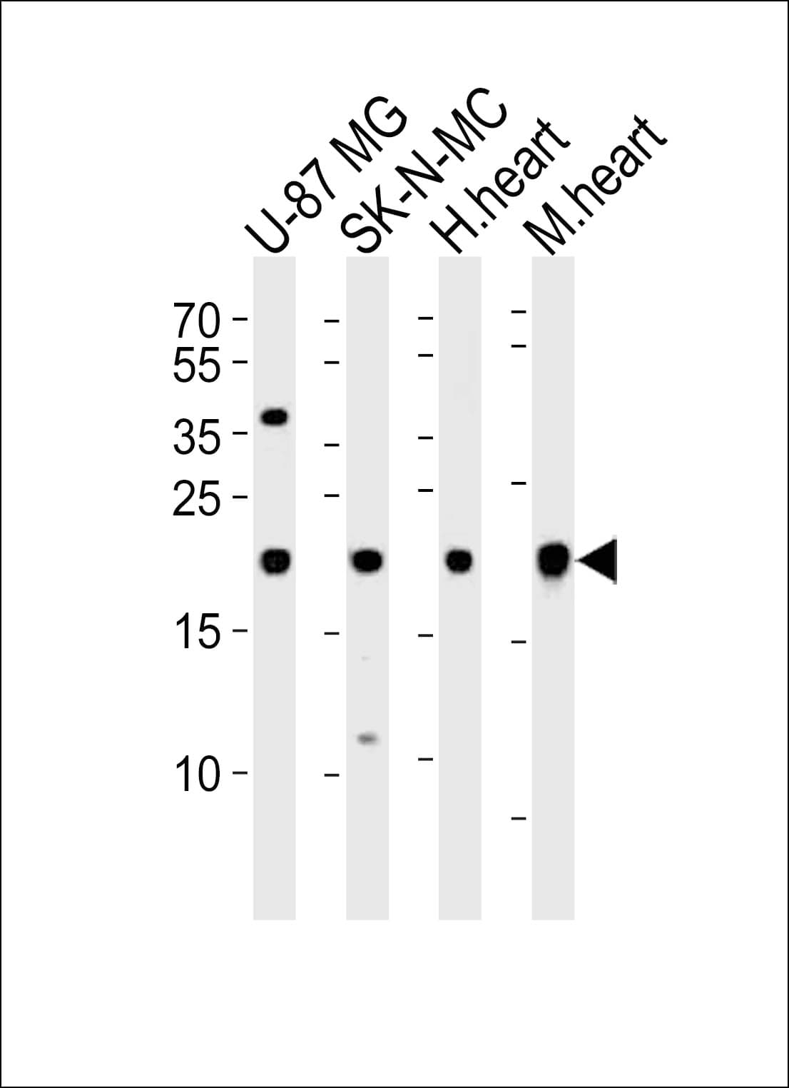 HES5 Antibody (aa81-115)