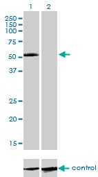 IL13RA2 / IL13R Alpha 2 Antibody (clone 2E10)