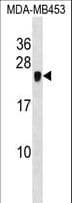 CRIP2 Antibody (aa179-208)