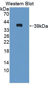 OXTR / Oxytocin Receptor Antibody (aa6-75)