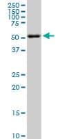 AKT2 Antibody (clone X1)