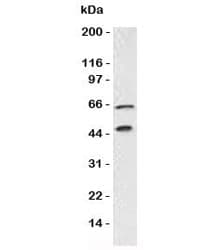 CHGA / Chromogranin A Antibody (clone bGRAN9, Ready-to-Use)