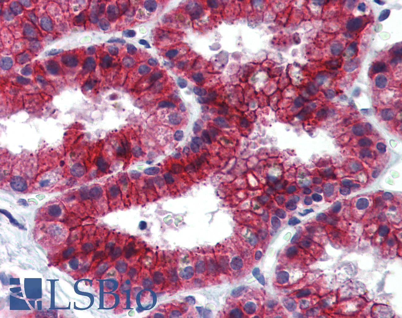 KDM4C / JMJD2C Antibody (C-Terminus)