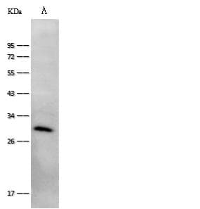 Polyclonal Rabbit anti-Human FGF23 Antibody (Preservative Free, WB)