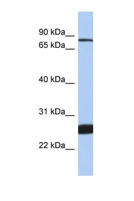 Polyclonal Rabbit anti-Human TCF11 / NFE2L1 Antibody (aa575-624, WB)