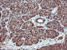 SERPINB1 Antibody (clone OTI3B4)