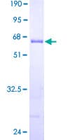 Human THTPA Protein (Recombinant GST)