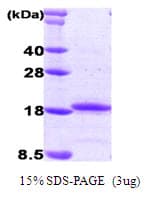 Human IL-33 Protein (Recombinant)