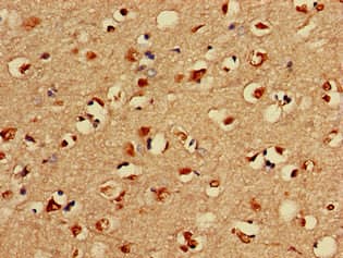Polyclonal Rabbit anti-Human LIMK1 / LIMK Antibody (IHC)