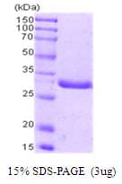 Human PCNA Protein (Recombinant)