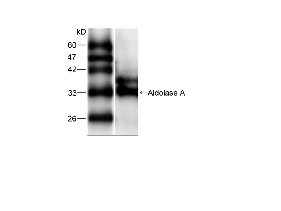 IHC-plus™ ALDOA / Aldolase A Antibody