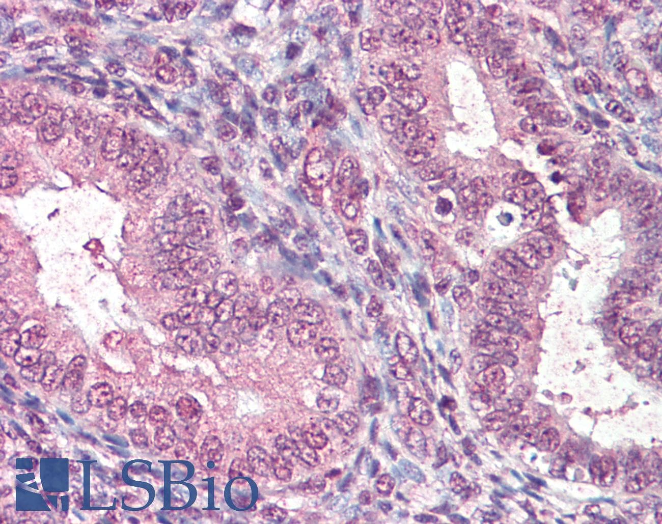 IHC-plus™ Polyclonal Goat anti-Human CTDSP1 / SCP1 Antibody (aa20-32, IHC)