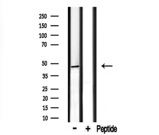 CADM2 Antibody