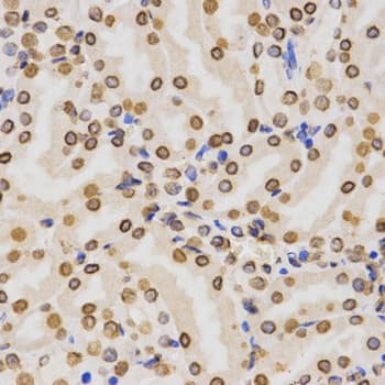 Histone H3 Antibody (Di-Methyl-Lys36)
