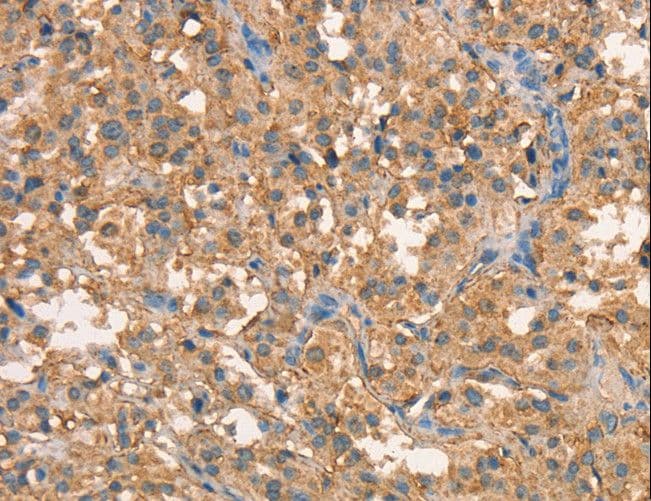 CRELD1 Antibody