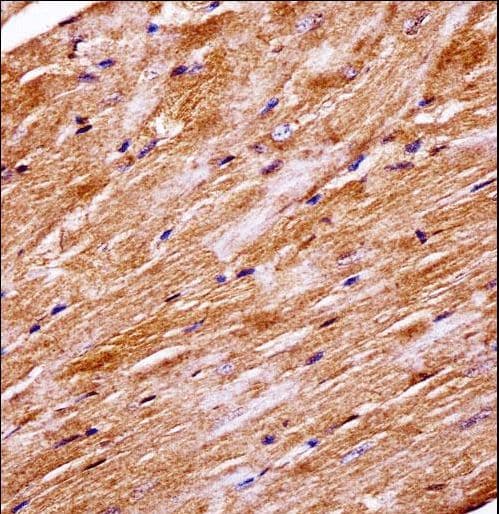 MAPK4 / ERK4 Antibody (aa67-94)