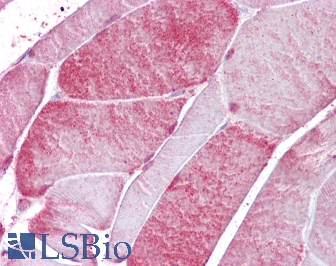 IHC-plus™ Polyclonal Goat anti-Human CSRP3 Antibody (aa150-163, IHC, WB)