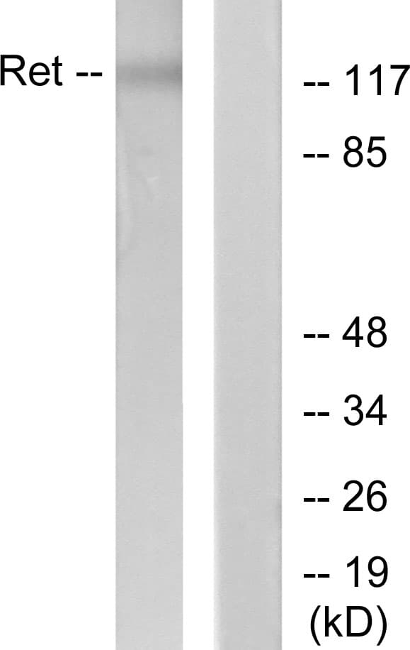 Polyclonal Rabbit anti-Human RET Antibody (aa1041-1090, WB)